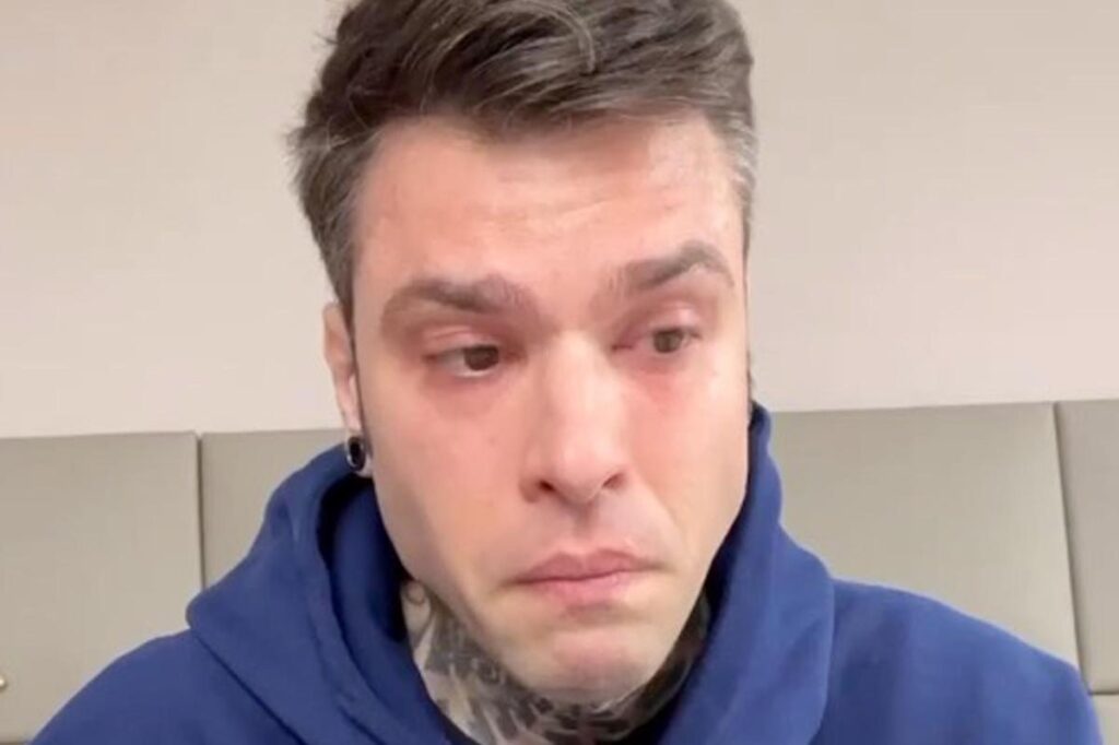 Fedez 