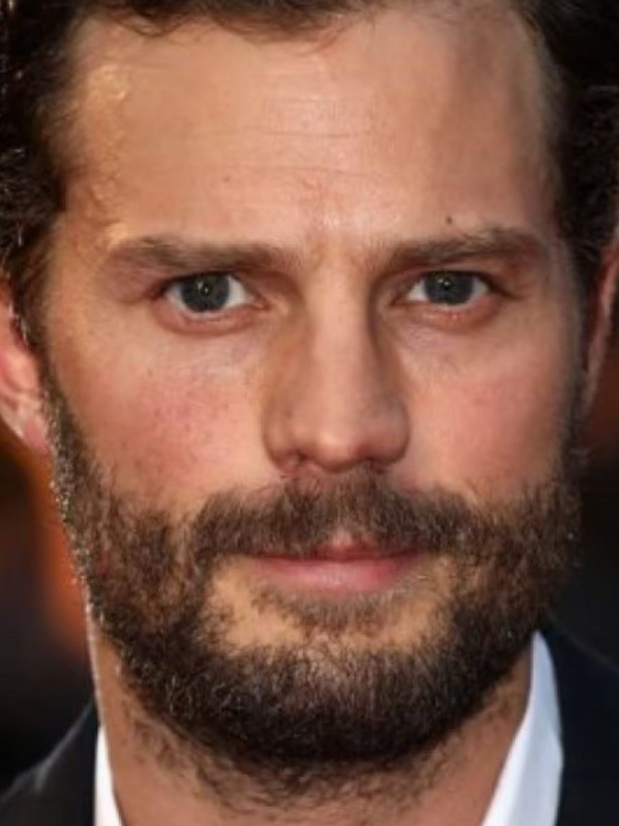 Jamie Dornan in ospedale: è stato morso da un bruco velenoso