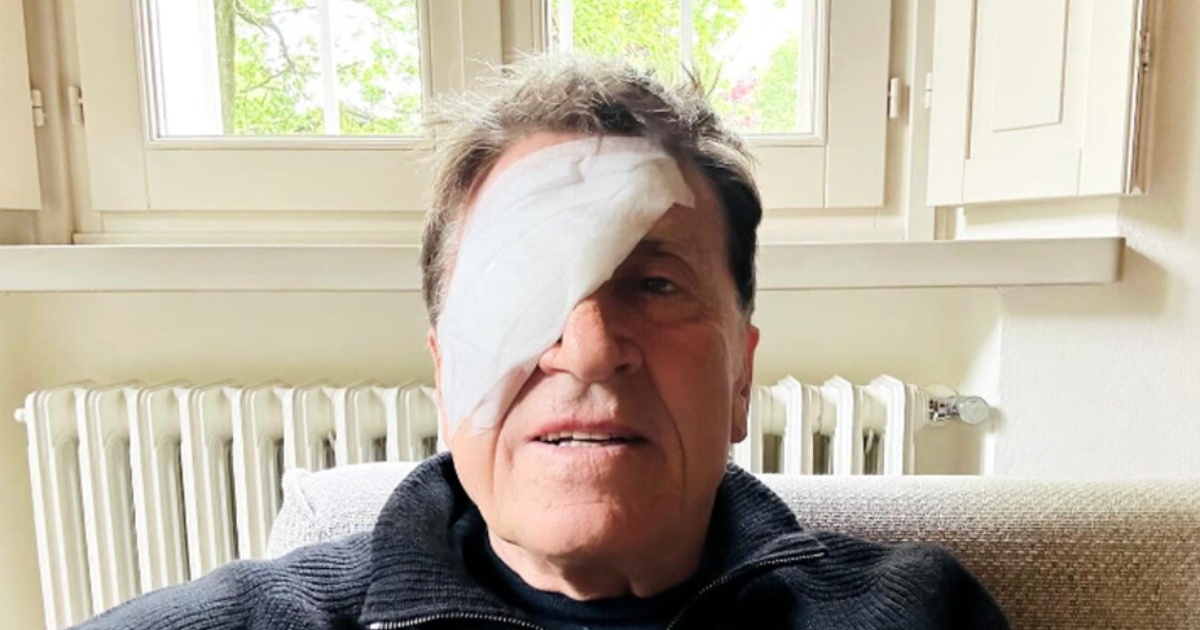 Gianni Morandi, la foto con l’occhio bendato preoccupa i fan