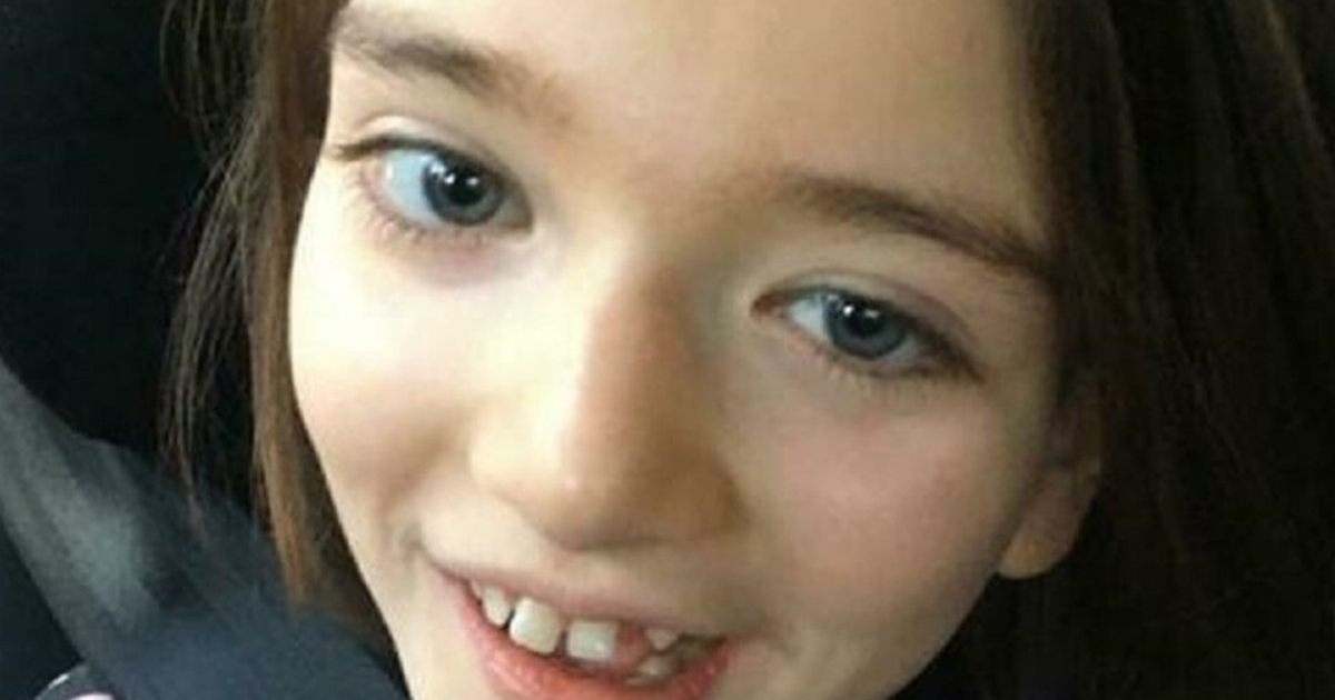 sindrome delle bambine dagli occhi belli