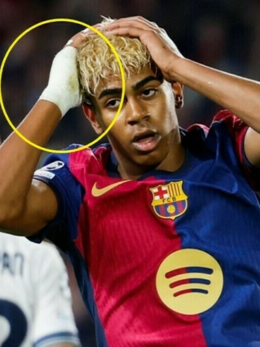 Yamal e i calciatori del Barcellona con la mano fasciata: il vero motivo