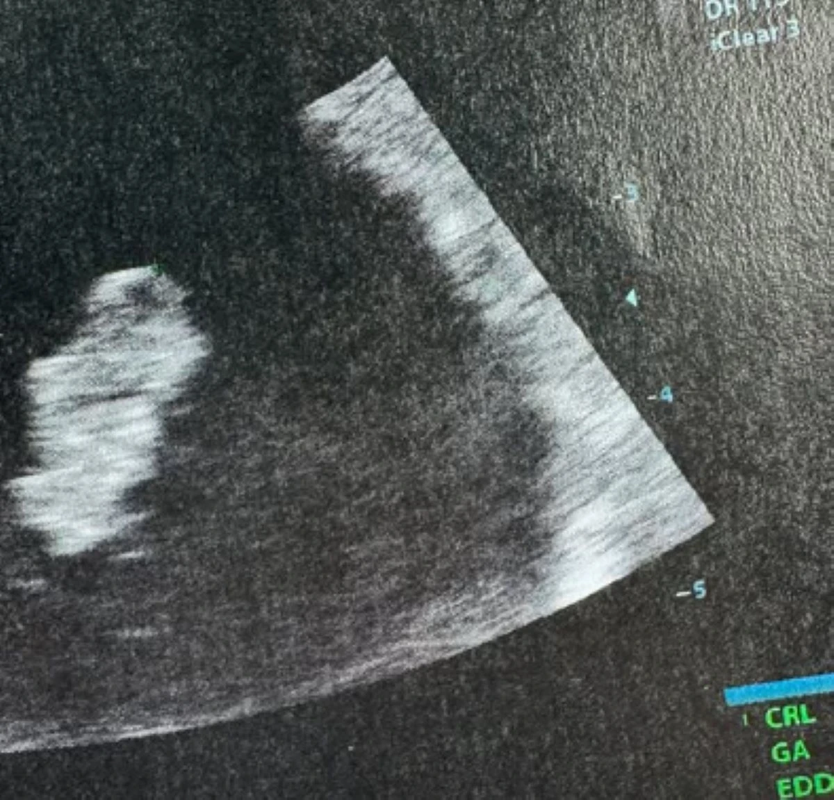 “Di nuovo incinta..”: terzo figlio in 3 anni per la famosa italiana “Di nuovo incinta..”: terzo figlio in 3 anni per la famosa italiana