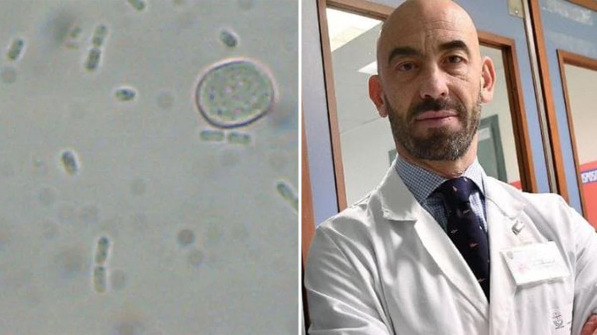 Batterio “mangia carne”, cos’è e dove si trova: le parole di Bassetti Batterio “mangia carne”, cos’è e dove si trova: le parole di Bassetti