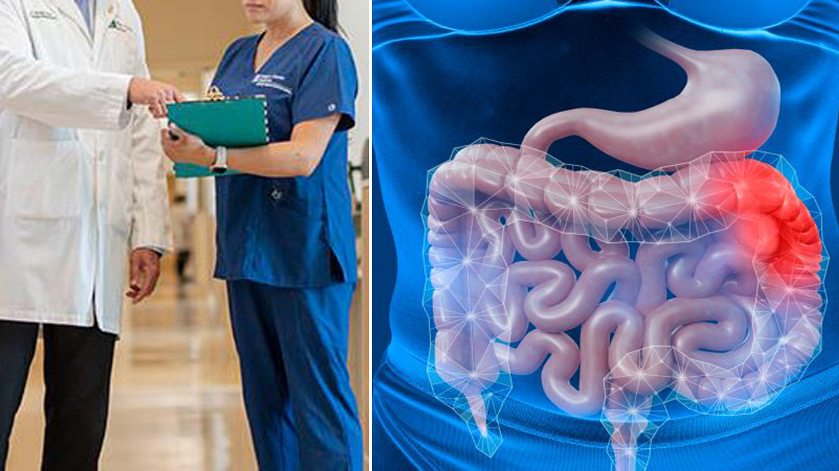 tumori gastrointestinali 232 boom di casi tra gli under 50 le cause e a cosa fare attenzione