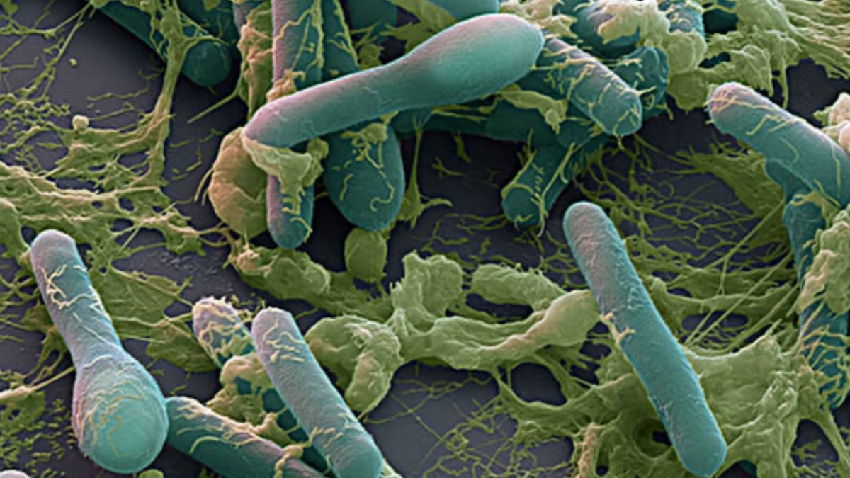 botulino killer i sintomi dell8217intossicazione e quali sono gli alimenti a rischio
