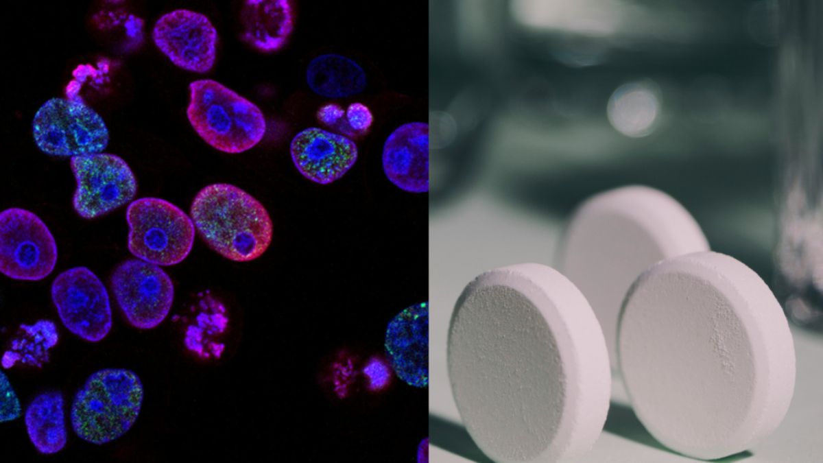 cancro al colon si ribalta tutto cosa fa l8217aspirina lo studio