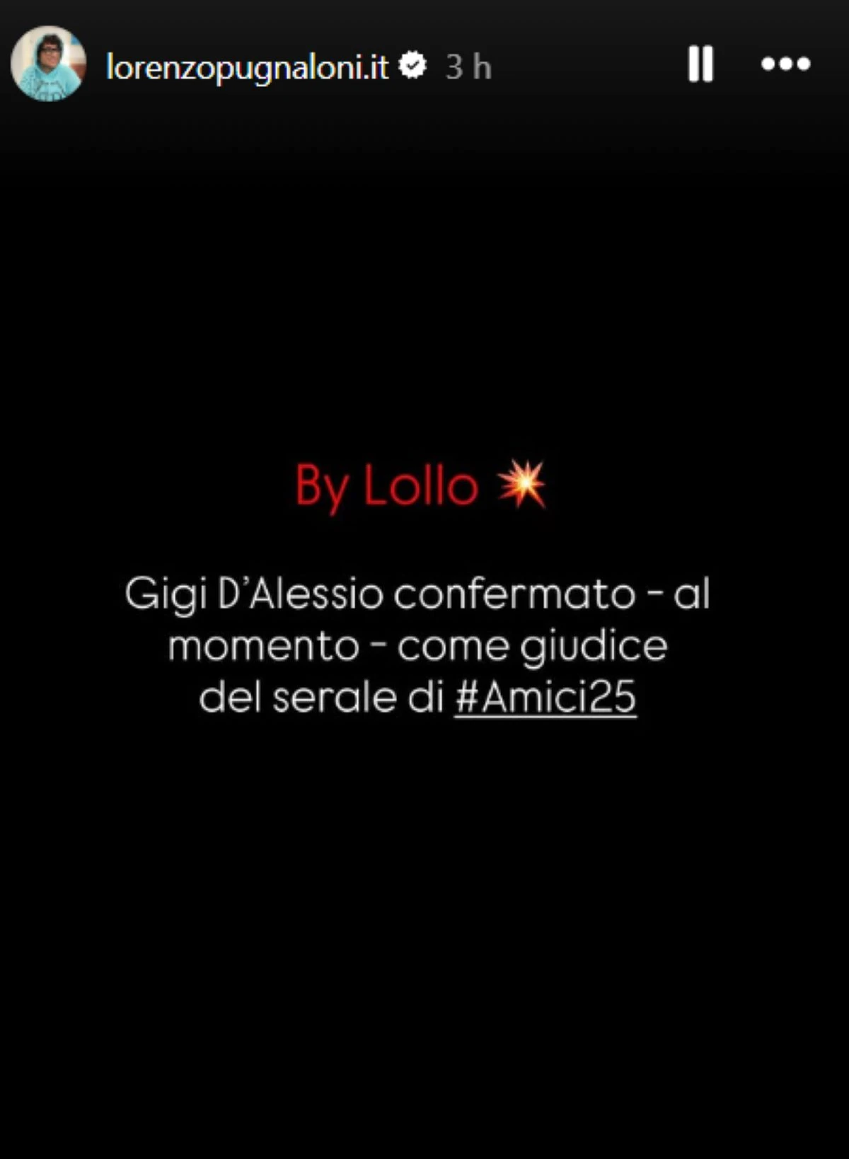 Gigi D'Alessio pronto per Amici 25