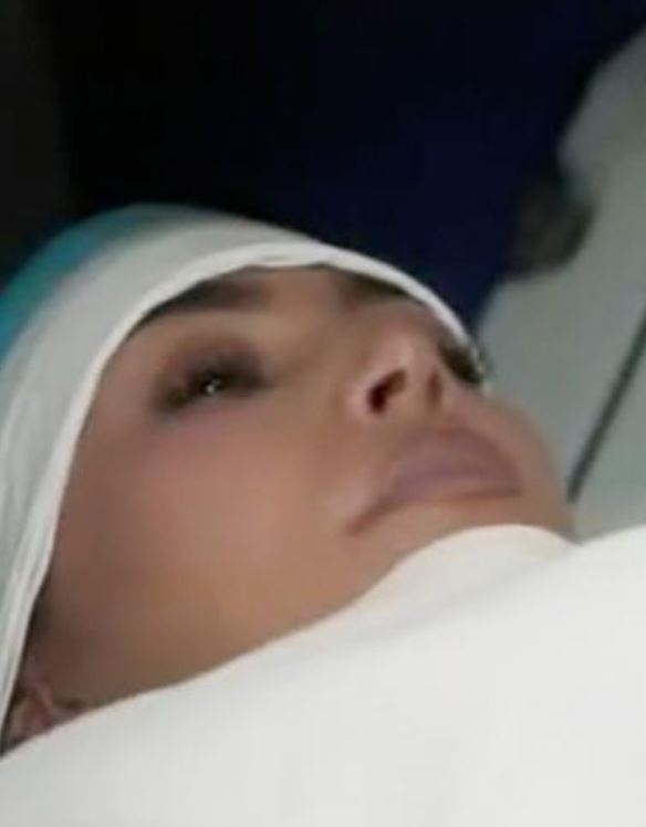 Kim Kardashian diagnosticata con aneurisma cerebrale, la rivelazione drammatica sulle cause