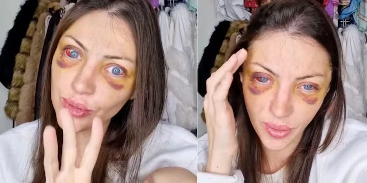 Barbara Jankavski Marquez, nota come Barbie umana, in uno scatto dai social