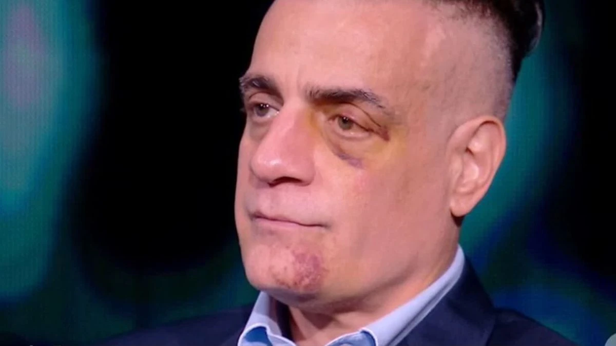 Cicalone, il racconto shock del pestaggio subito (VIDEO)