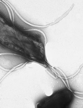 Sintomi di Helicobacter pylori: quando prestare attenzione