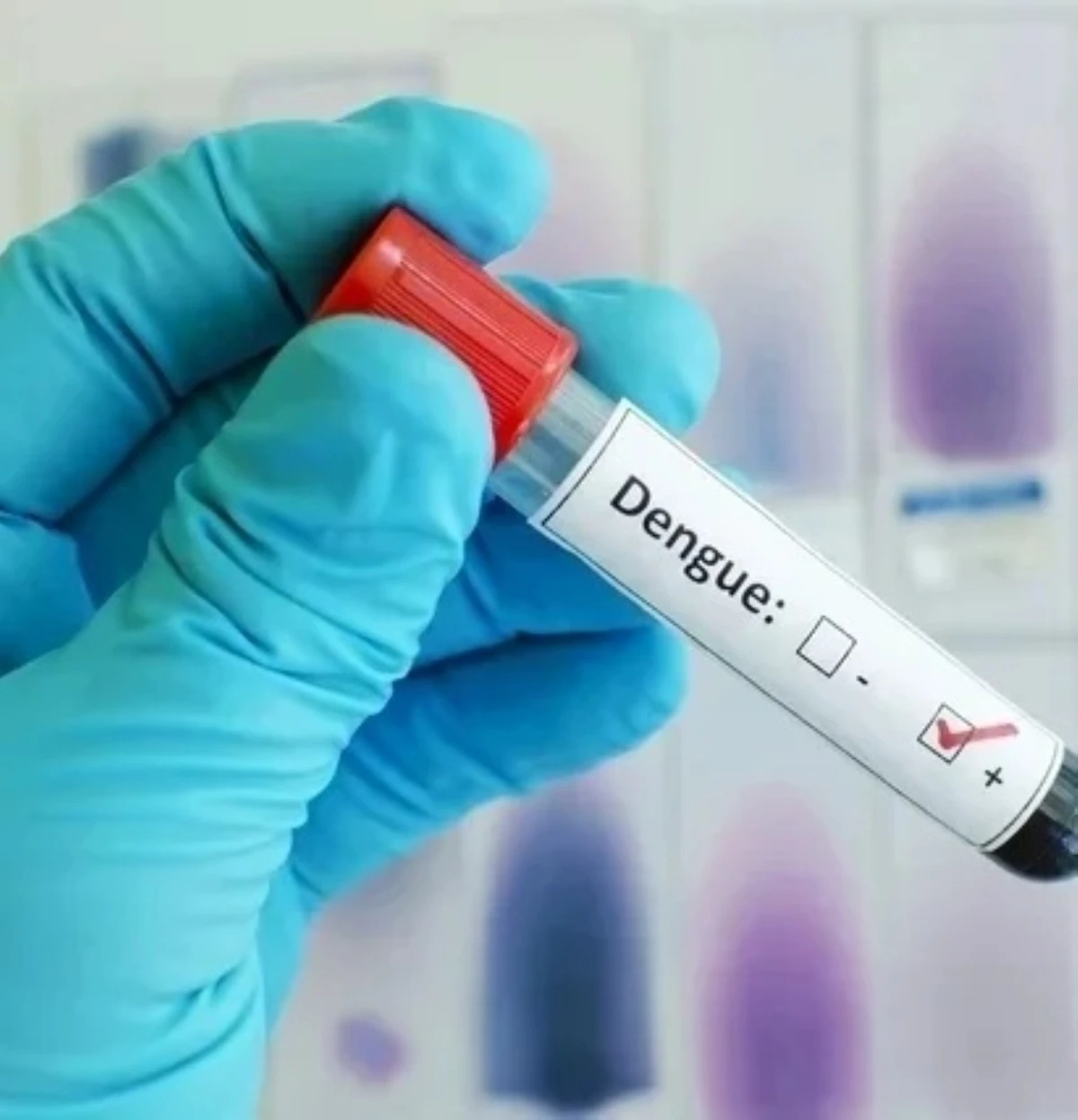 Emergenza sanitaria, operazioni di prevenzione a Cuba