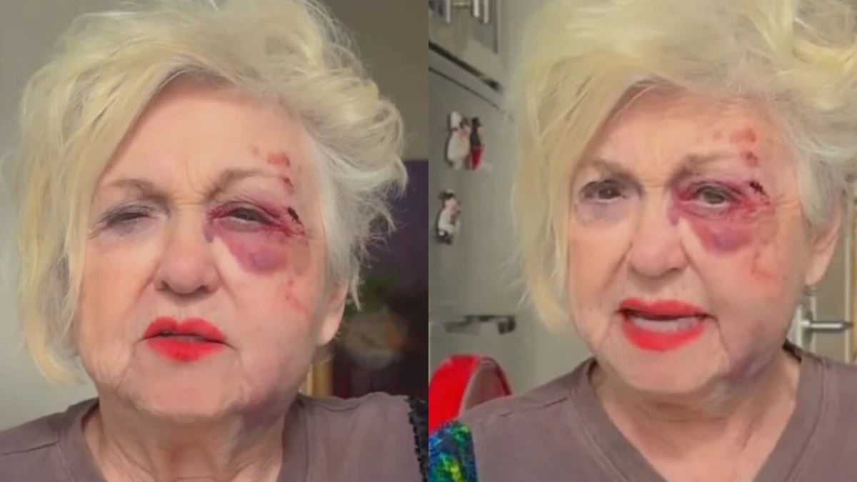 Immagine diffusa sui social dopo l’incidente di Wanna Marchi