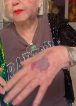 Wanna Marchi investita da un’auto a Milano: come sta e come è successo