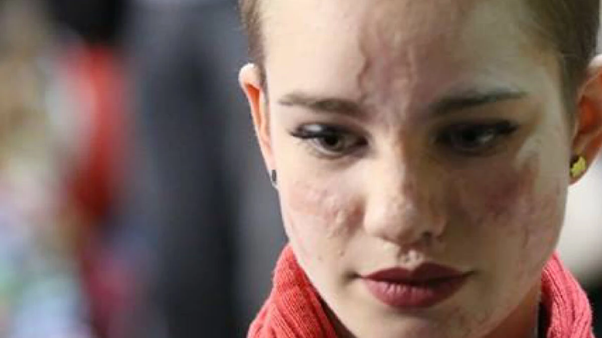 Bebe Vio annuncia l'addio alla scherma e la nuova sfida dei 100 metri