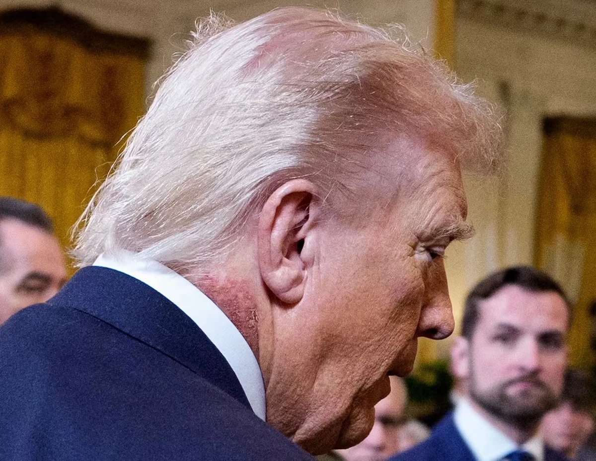 Donald Trump durante un evento: foto ripresa dai media nel contesto delle notizie sulla salute