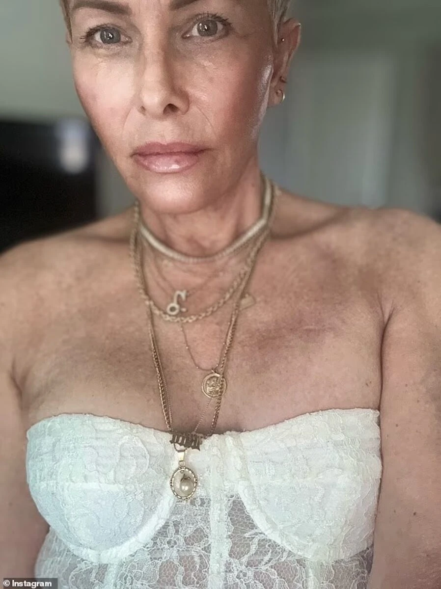 Nicole Eggert mostra i segni dell’intervento nella sua lotta contro il tumore al seno