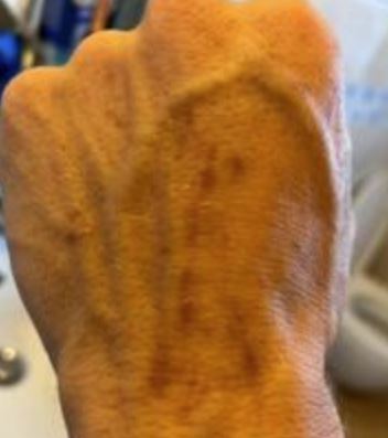 Turista attaccato da uno squalo in Sardegna: ferito lievemente dopo cinque morsi