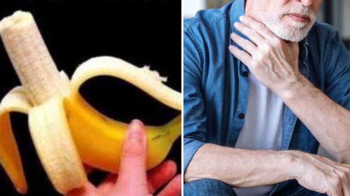 mangia una banana e scopre di avere un tumore fate molta attenzione a questo da Tvzap.it mangia una banana e scopre di avere un tumore fate molta attenzione a questo