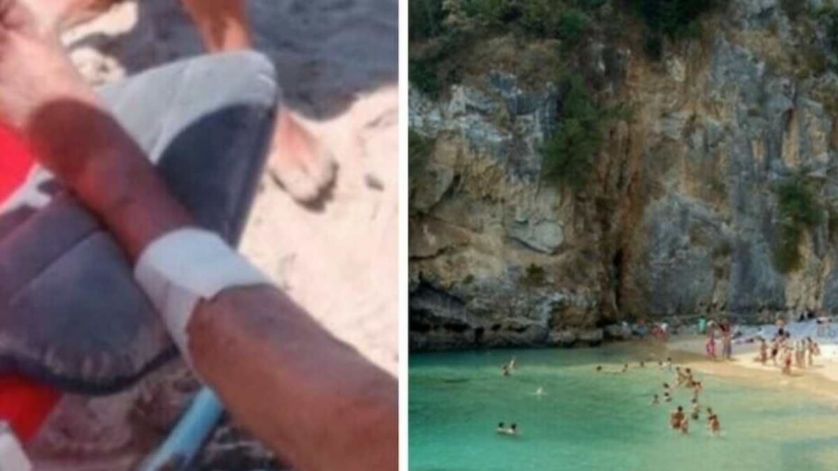 lesioni e tanto sangue turisti morsi da pesci panico tra i bagnanti la scoperta dopo gli attacchi da Tvzap.it lesioni e tanto sangue turisti morsi da pesci panico tra i bagnanti la scoperta dopo gli attacchi