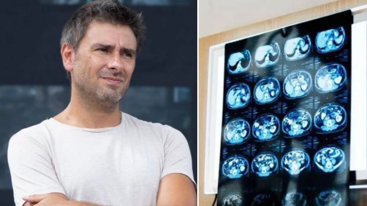 di battista le ipotesi sul malore cosa indica un mal di testa forte e improvviso da Tvzap.it di battista le ipotesi sul malore cosa indica un mal di testa forte e improvviso