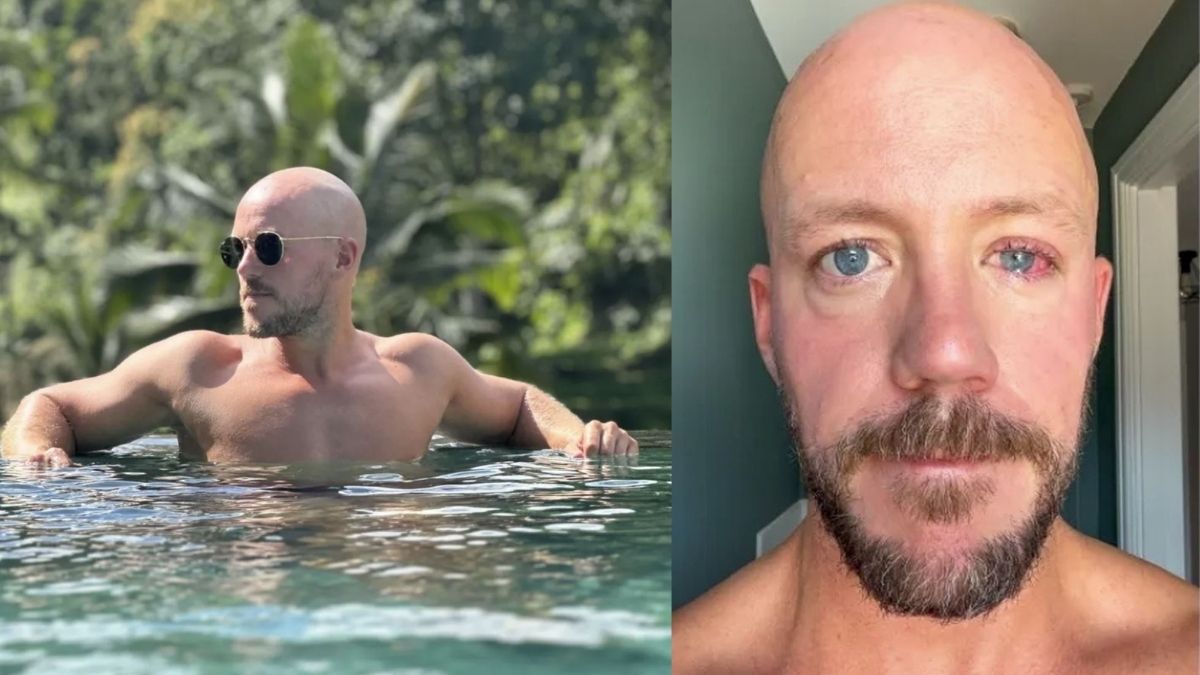 fa un bagno in piscina ora rischia di diventare cieco cosa 232 successo da Tvzap.it fa un bagno in piscina ora rischia di diventare cieco cosa 232 successo