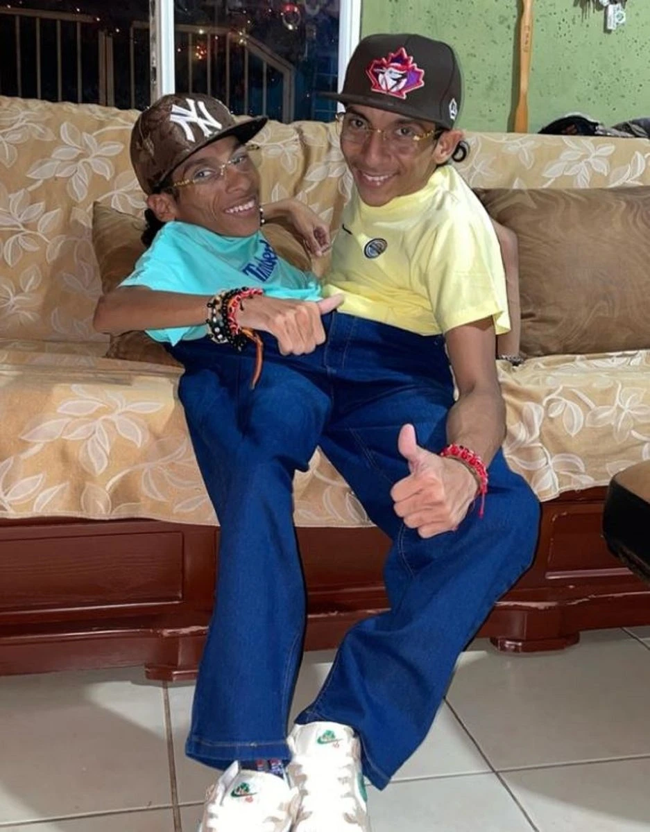 Ecuador, tragedia per i gemelli siamesi Cevallos: morti a 27 anni dopo due infarti, follower in lutto